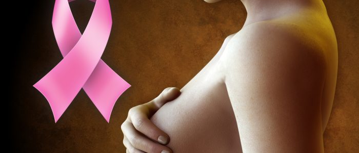 Рак груди карцинома 12